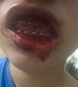 Garoto de 18 anos sofre transfobia em Barueri