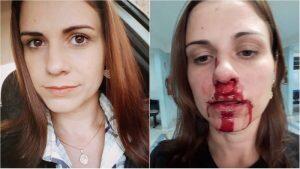 mulher agredida