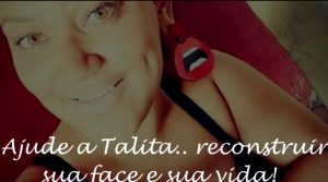 mulher nariz arrancado pelo ex