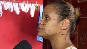 inquilina esfaqueada barueri