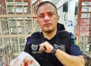 gcm carapicuíba tem nariz fraturado