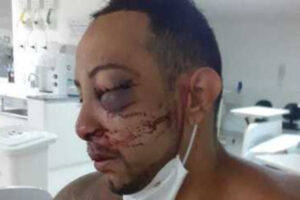 ambulante agredido cptm carapicuíba