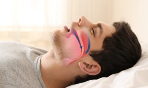 apneia do sono
