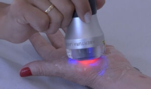 Clinica de Osasco tem tratamento inovador com laser para fibromialgia, artroses e dores crônicas