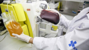 tratamento contra covid-19 osasco plasma