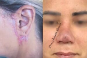 dentista cotia harmonização facial