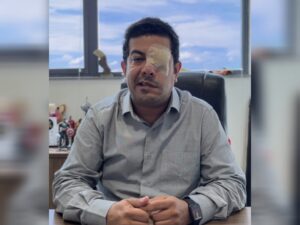vereador de carapicuíba fabinho reis paralisia facial