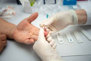 testes rápidos hiv