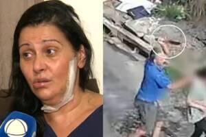 mulher reencontra homem ataques do ex-marido carapicuíba (1)
