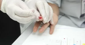 testagem HIV Barueri