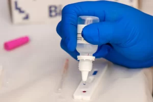 testes rapidos HIV osasco