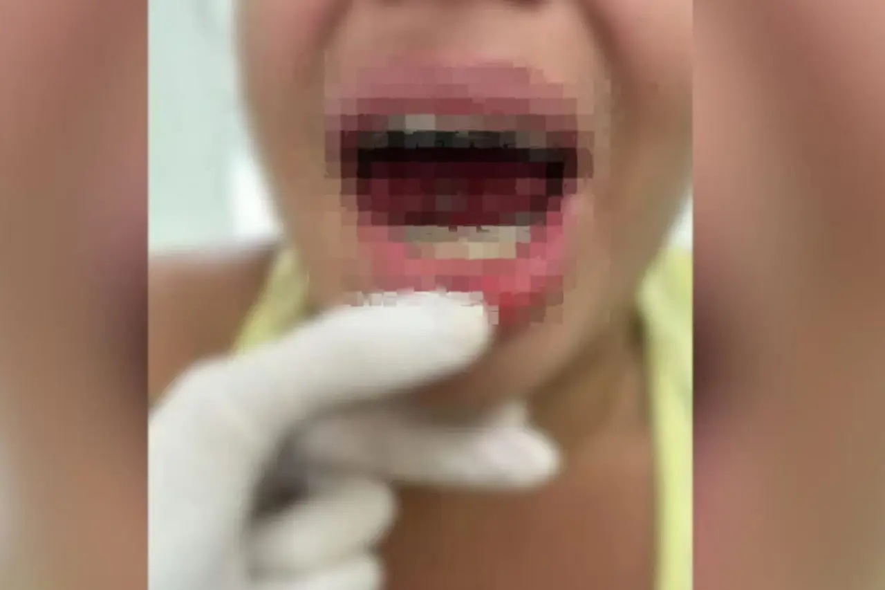 mulher tem parte da lingua arrancada em osasco