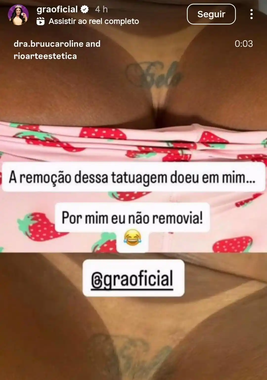 remoçao tatuagem gracyanne