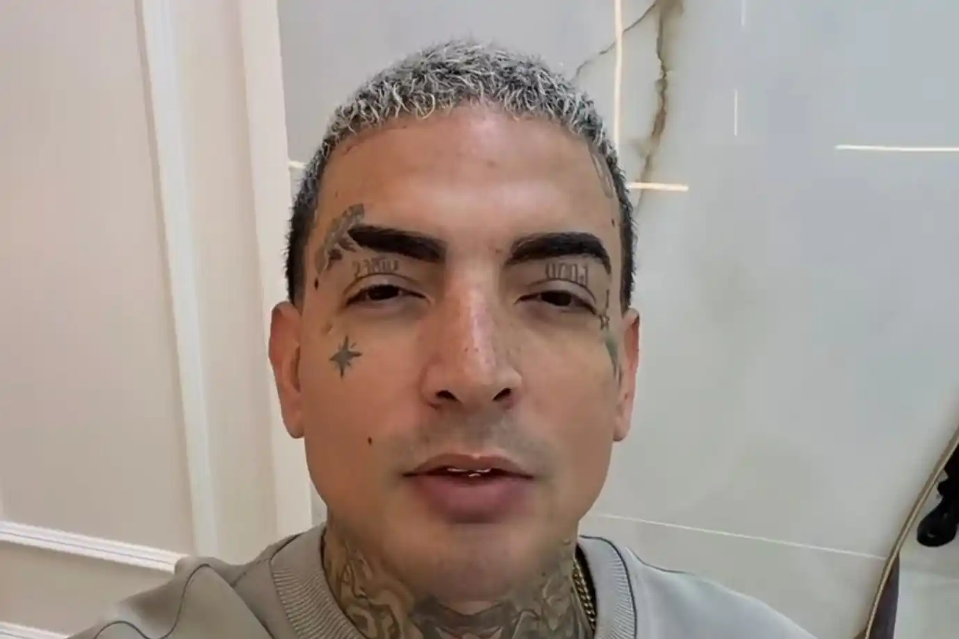 mc guime faz harmonizacao facial