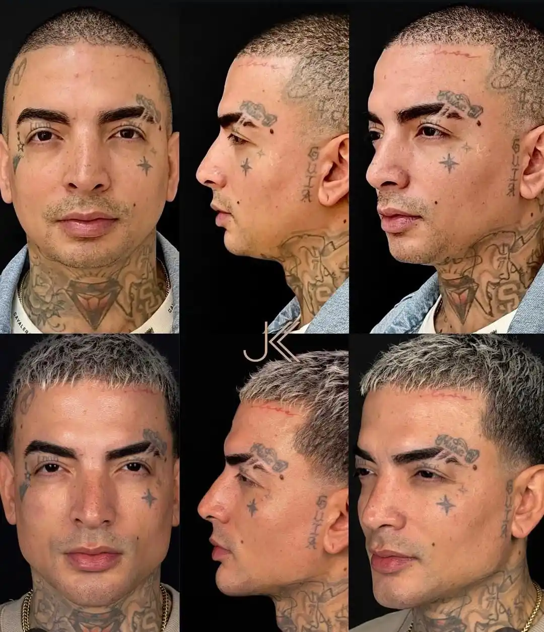mc guime harmonizacao